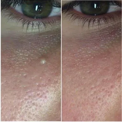 two products on a table