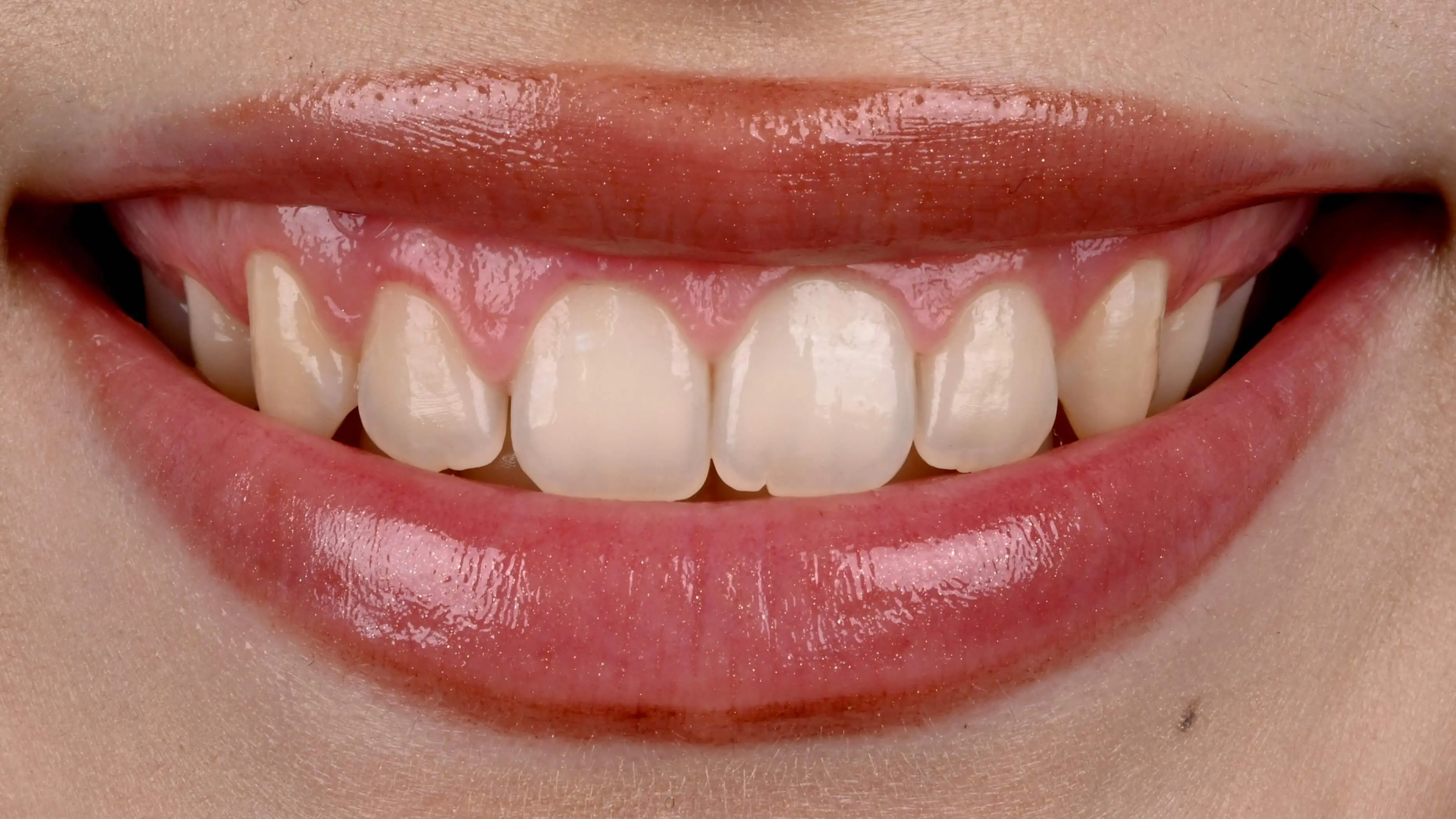 Foto mit Polarizationsfilter