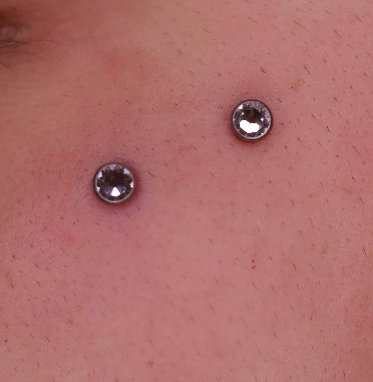 Dermal piergings at Calavera ink Berlin