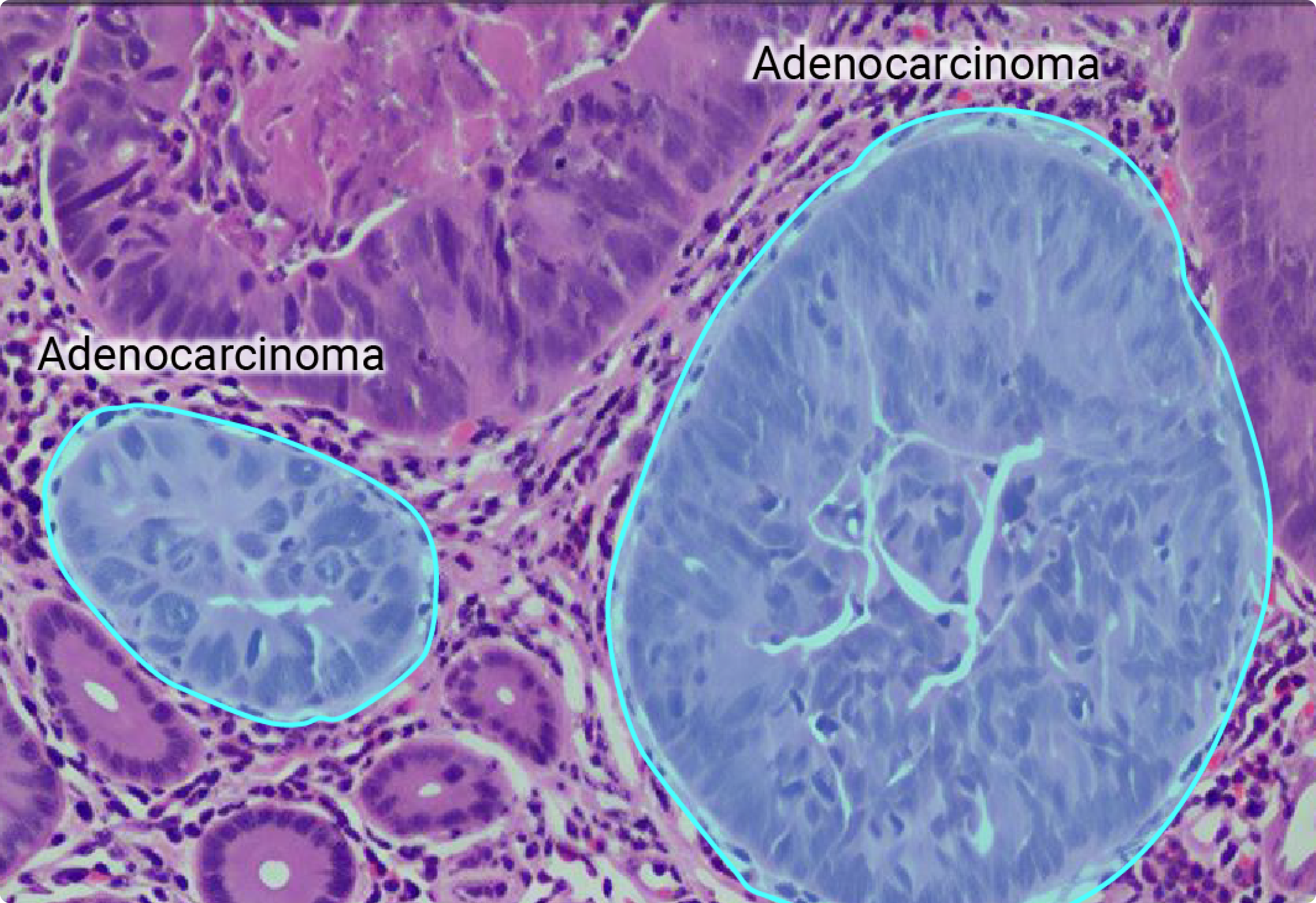 pharmaceutical-biology ai vision inspection