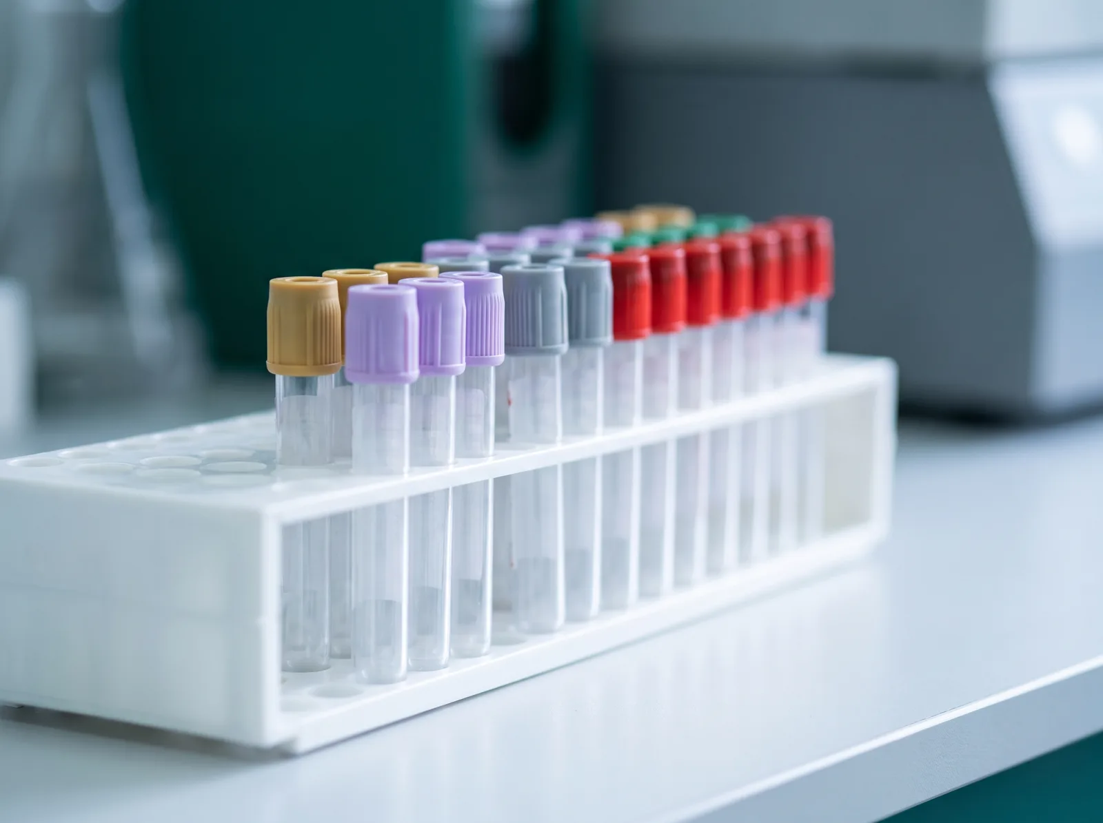 Blood sample tubes with coloured caps standing in a rack