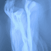 DEXA scan measuring bone mineral density, lean muscle mass, body fat, and body composition.