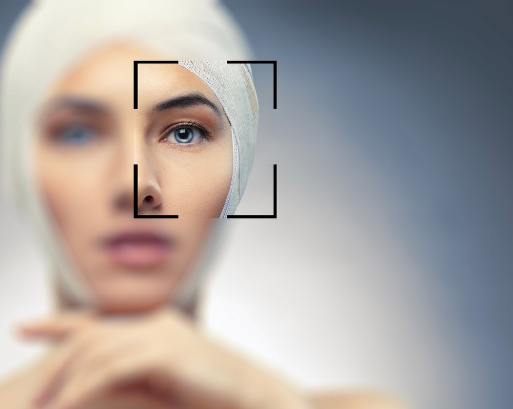 Plastyka powiek górnych