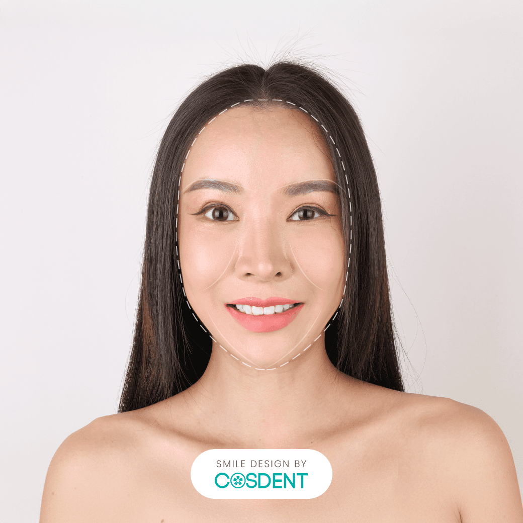 หน้าจีน ยิ้มกว้าง 19 ซี่