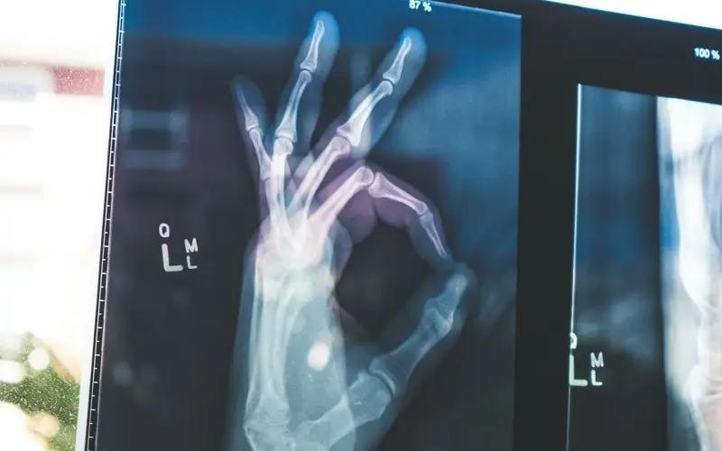 4 conseils de pro pour diminuer vos coûts de santé à Hong Kong