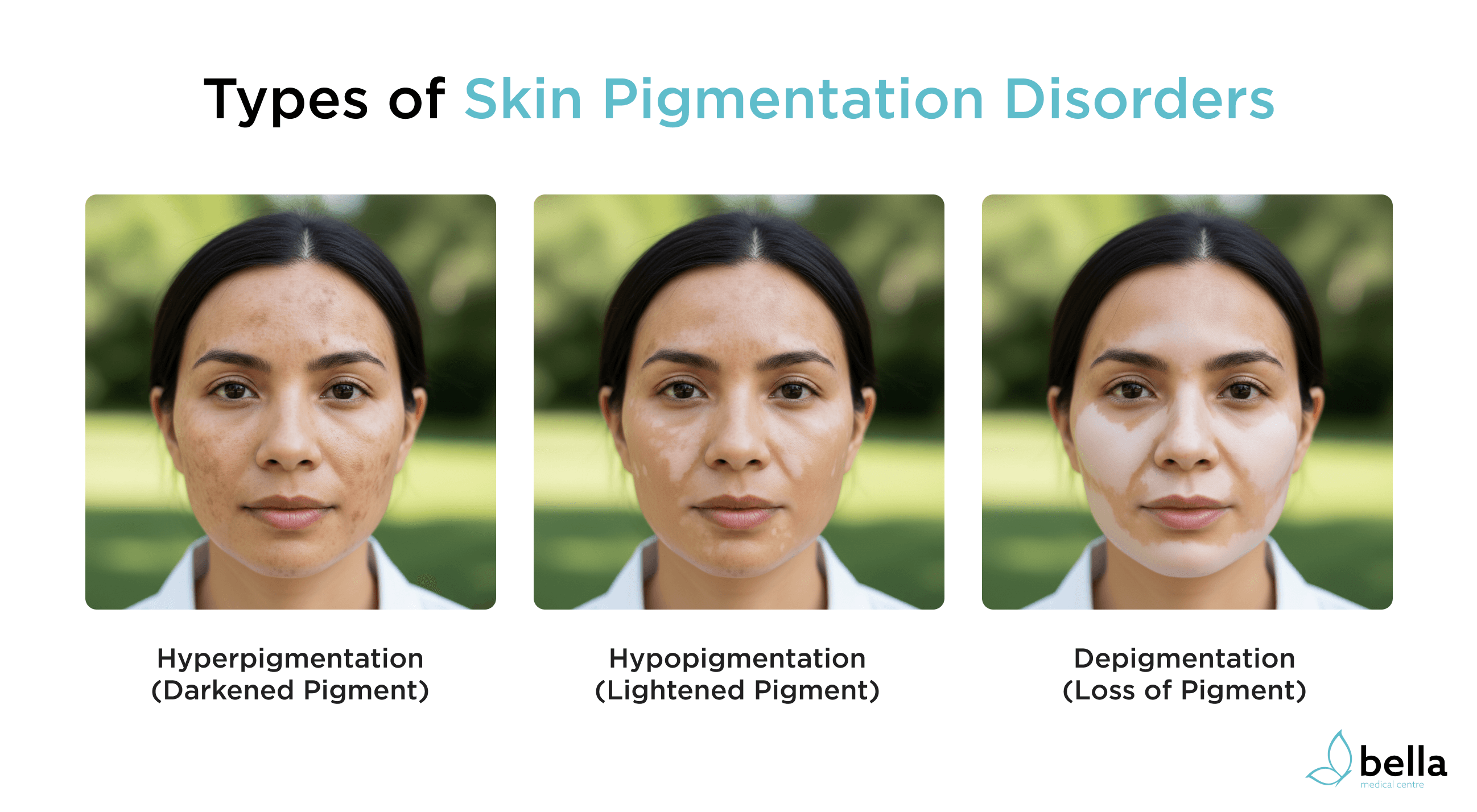 Different types of skin pigmentation disorders
