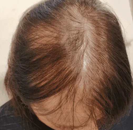 Hair Before