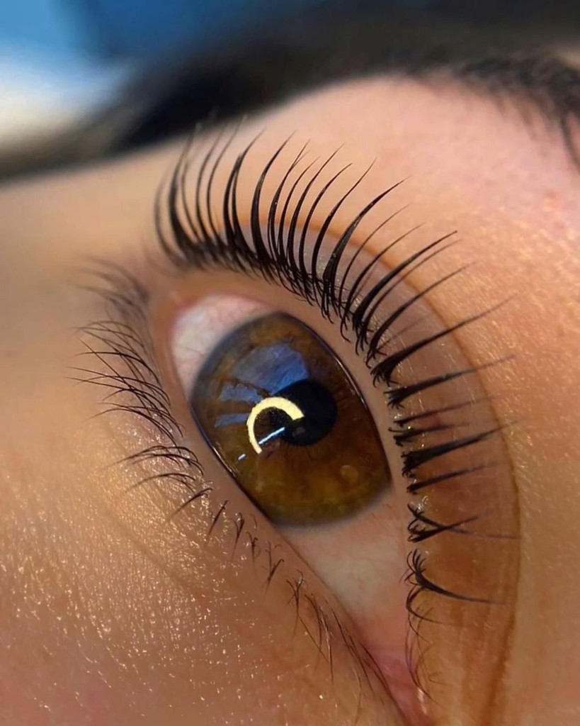 Crop view of an eye, after the procedure