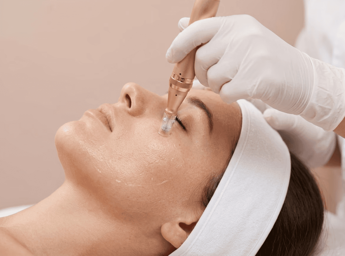 Dermapen mikroadatu terapija sejas ādas atjaunošanai