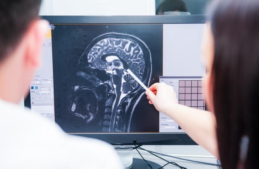 Two health professionals looking at a cross-sectional image of the brain