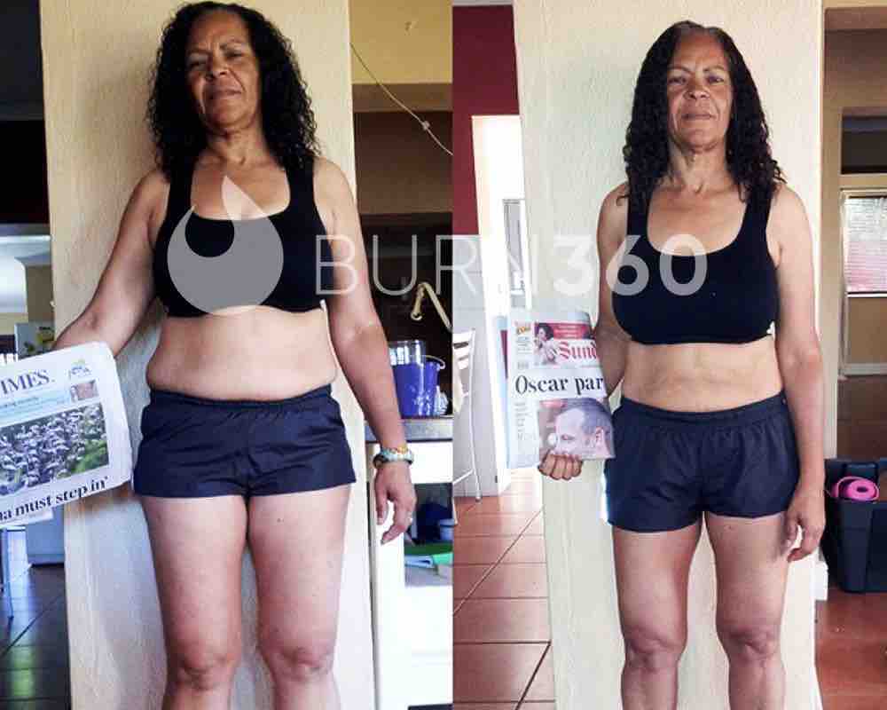 Vivienne's before and after photo (front)