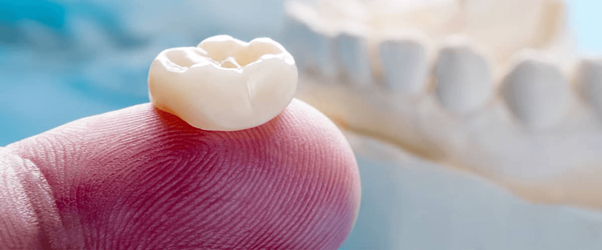 dental crown