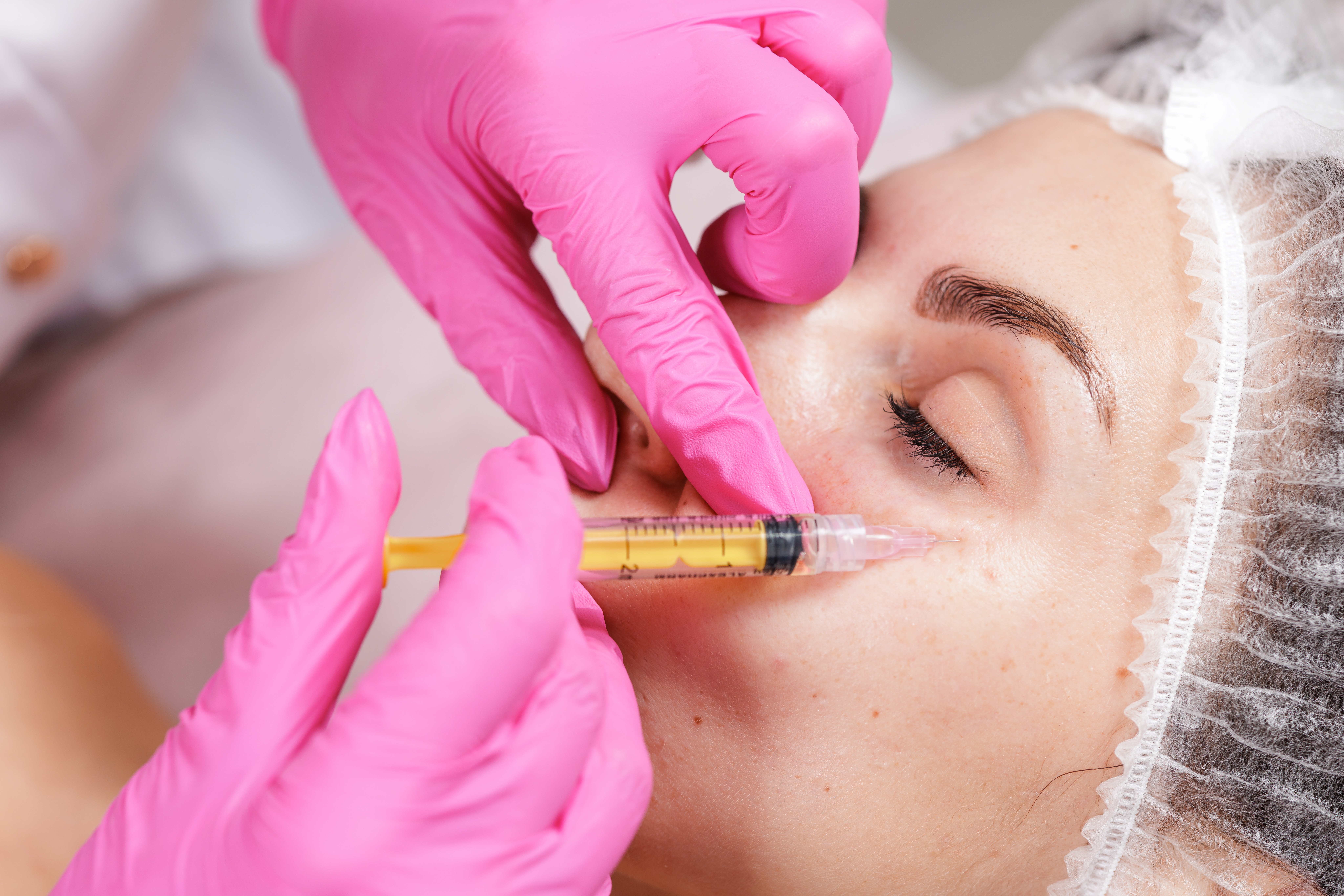 Under-Eye Fillers