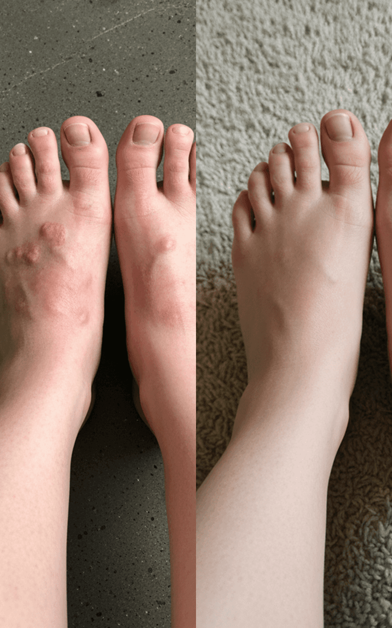 Before and after treatment - arm