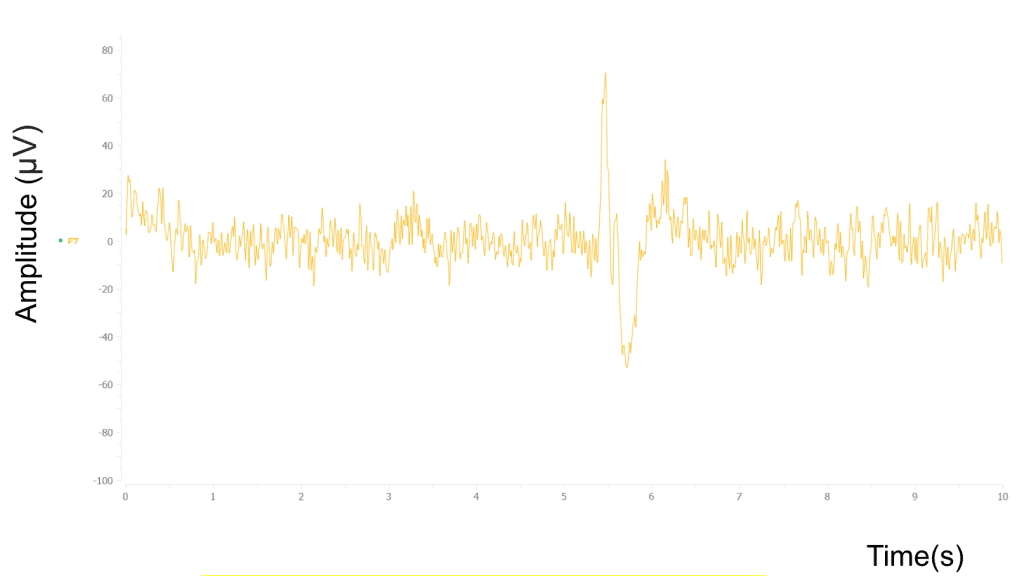 Raw EEG in time domain