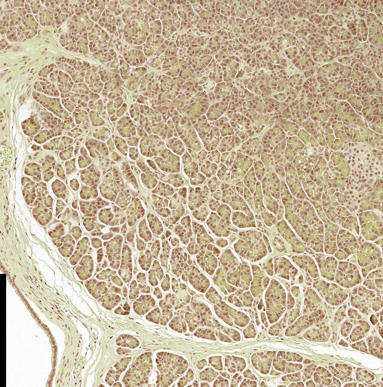 Microscopic view of tissue, showing a textured surface with various shades of brown and white areas.