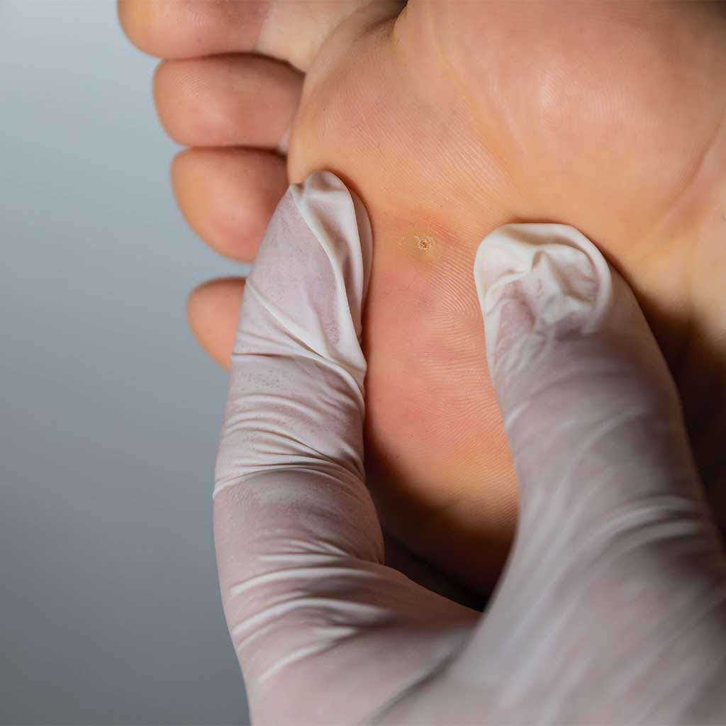 Podiatry foot treatment