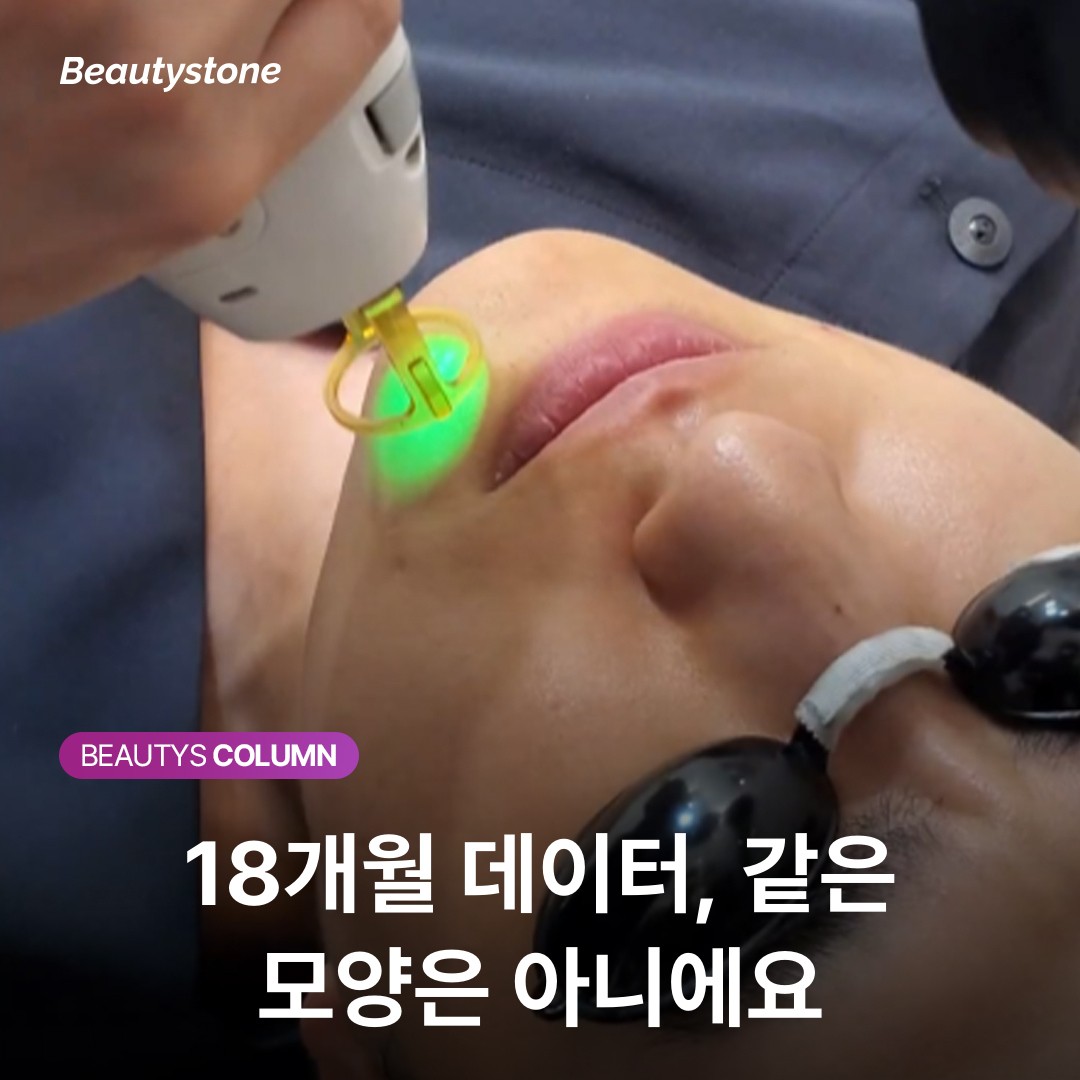 [요약] 쥬비덤 볼륨업 효과와 18개월 지속기간의 진짜 의미