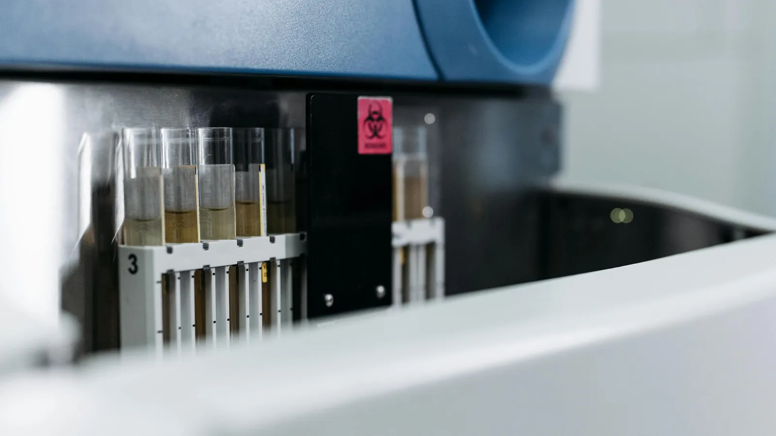 MCV and the Bigger Picture: What Other Markers to Check