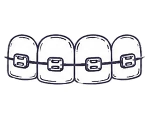 Hand-drawn illustration of teeth with braces for orthodontic treatment