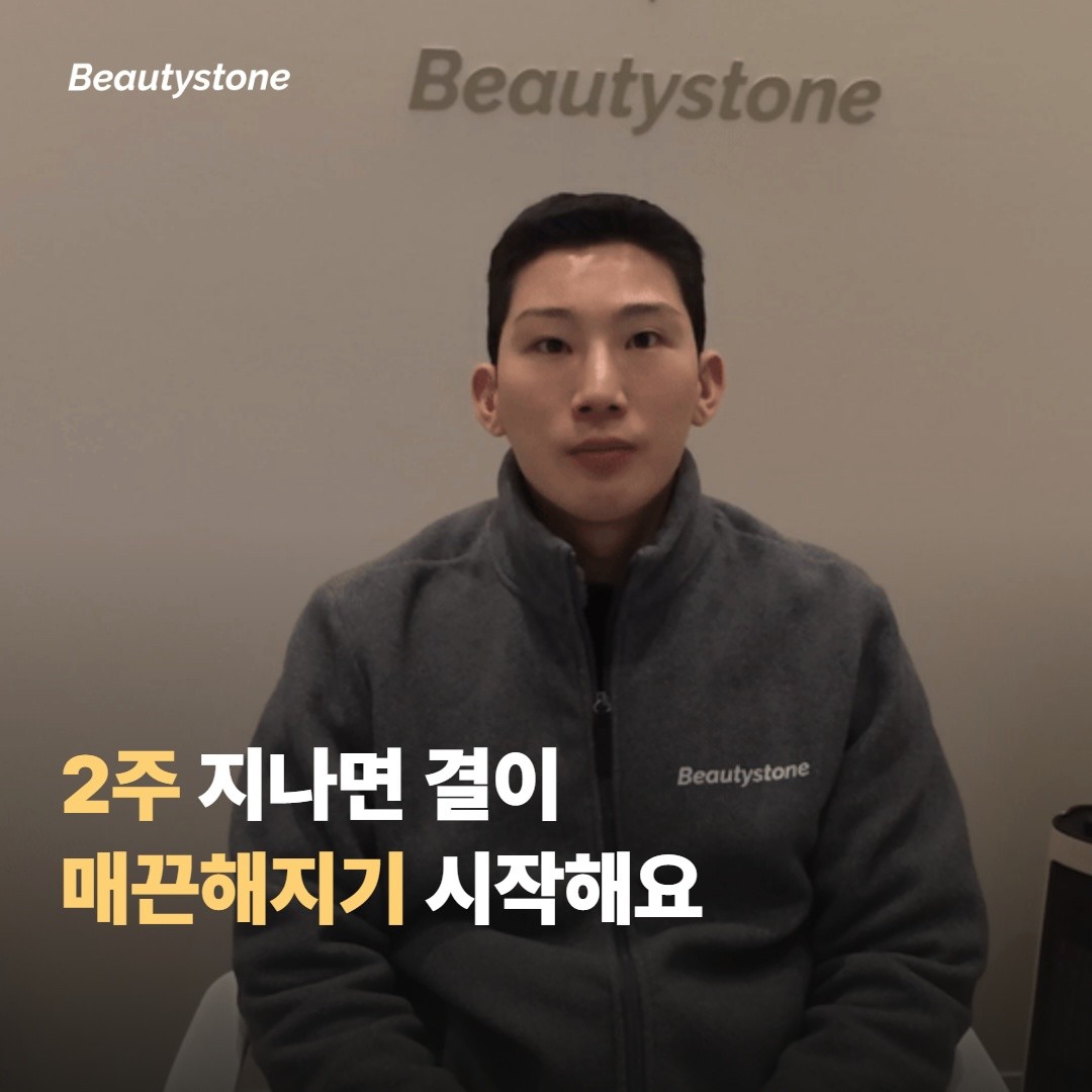Day 3~Day 5 — 점 자국이 살짝 어두워졌다 정리되는 구간