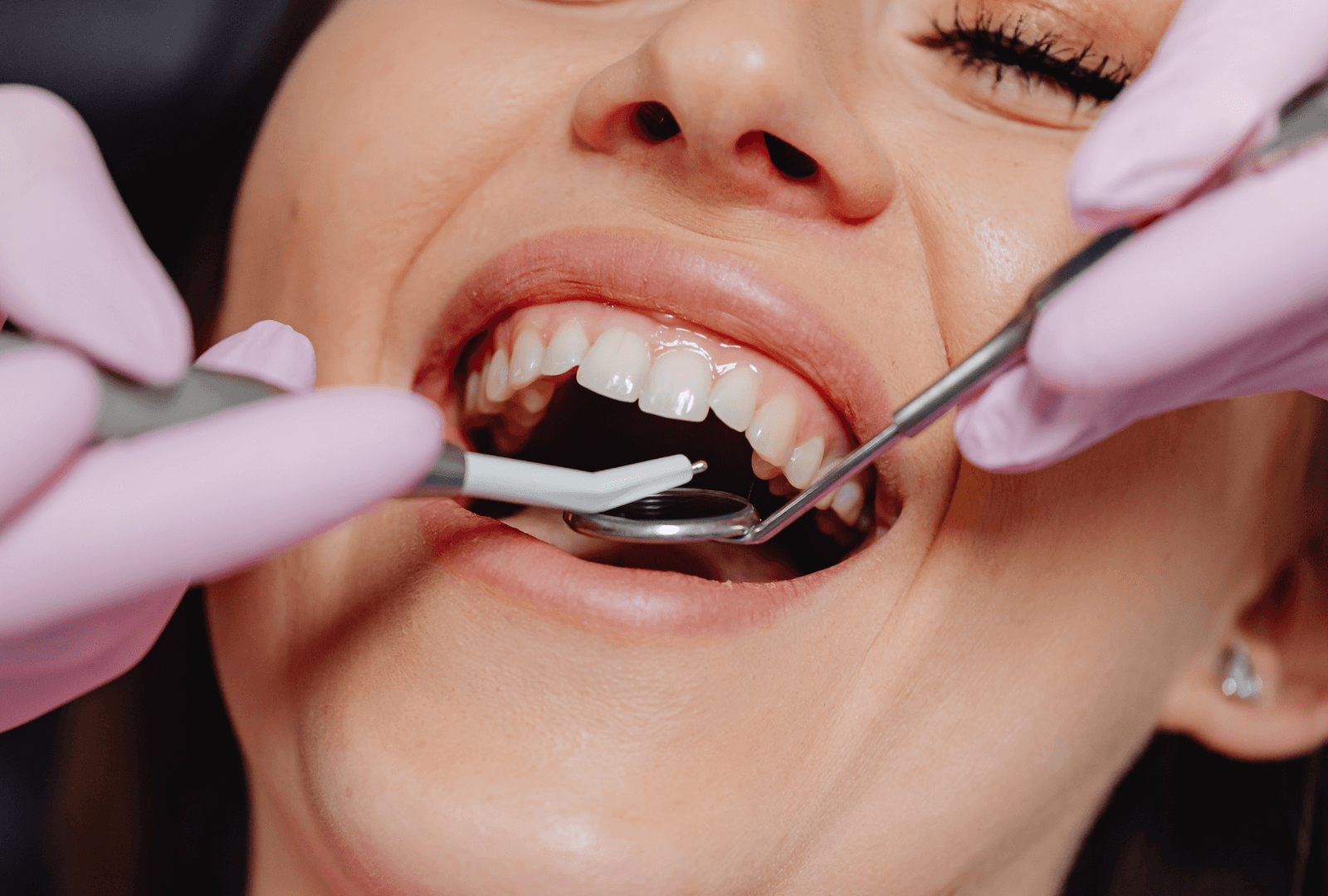 Surgical Procedures