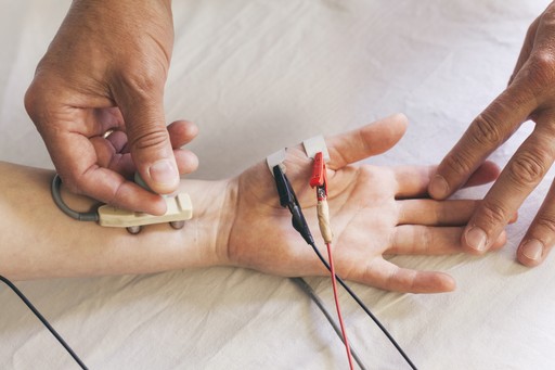 Neurologist performing nerve conduction study on the hand of a patient during an electromyography consultation