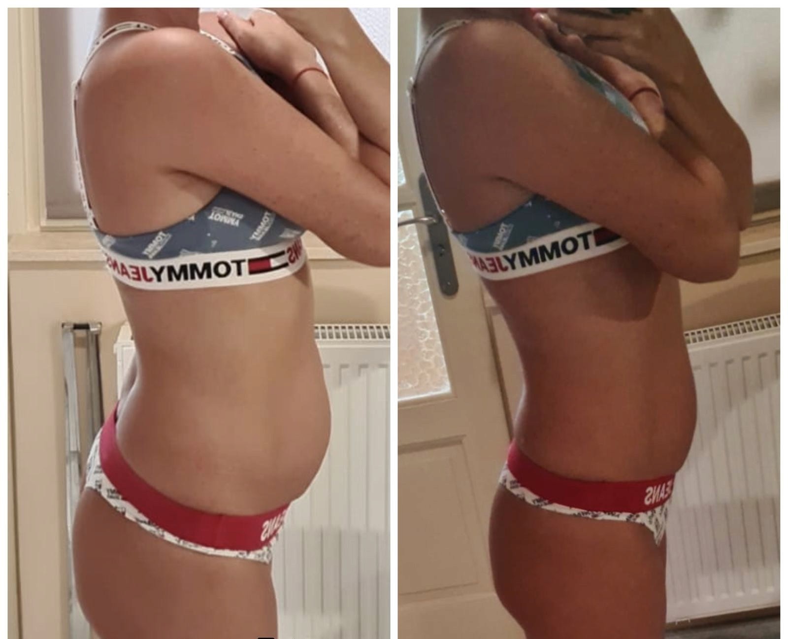 Transformation Photo