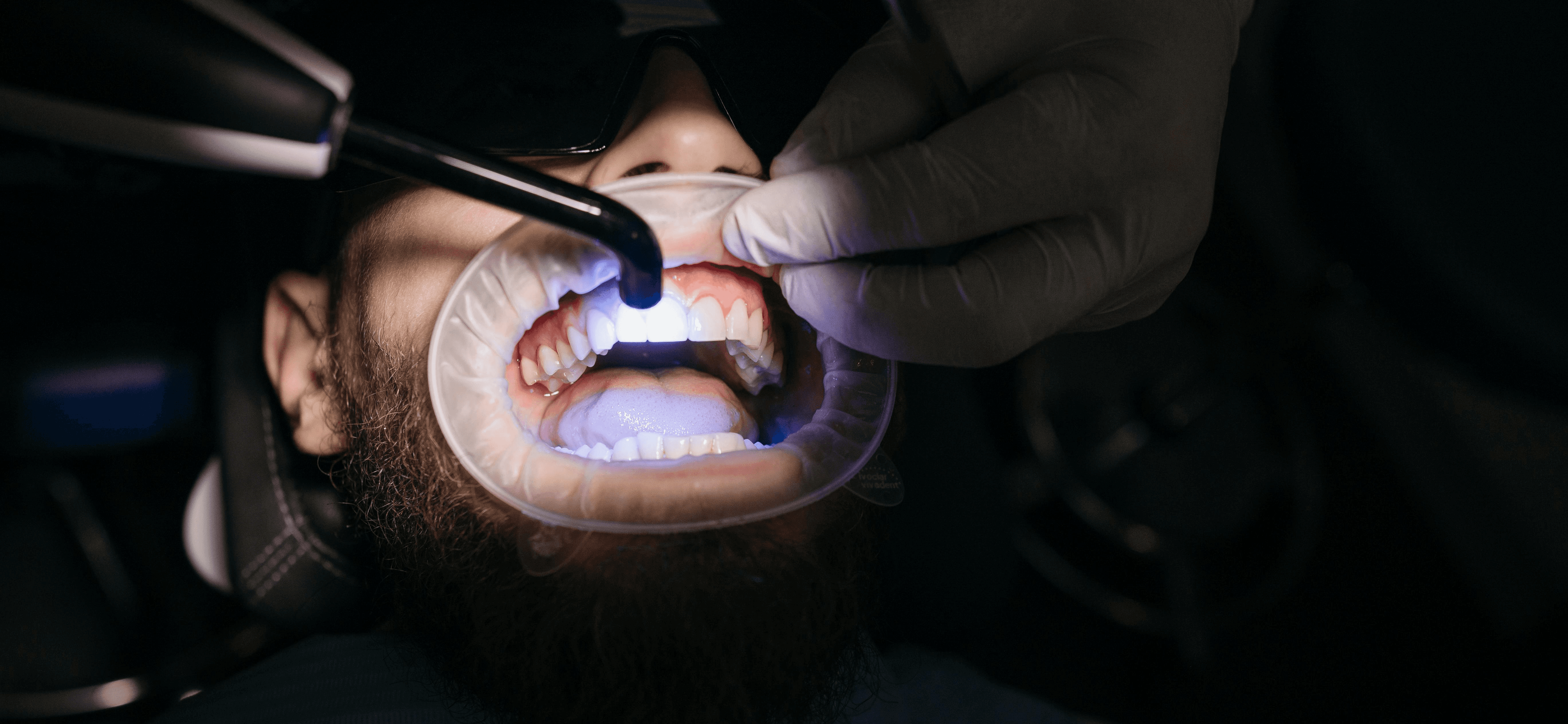 Cosmetic Dentistry in Smyrna