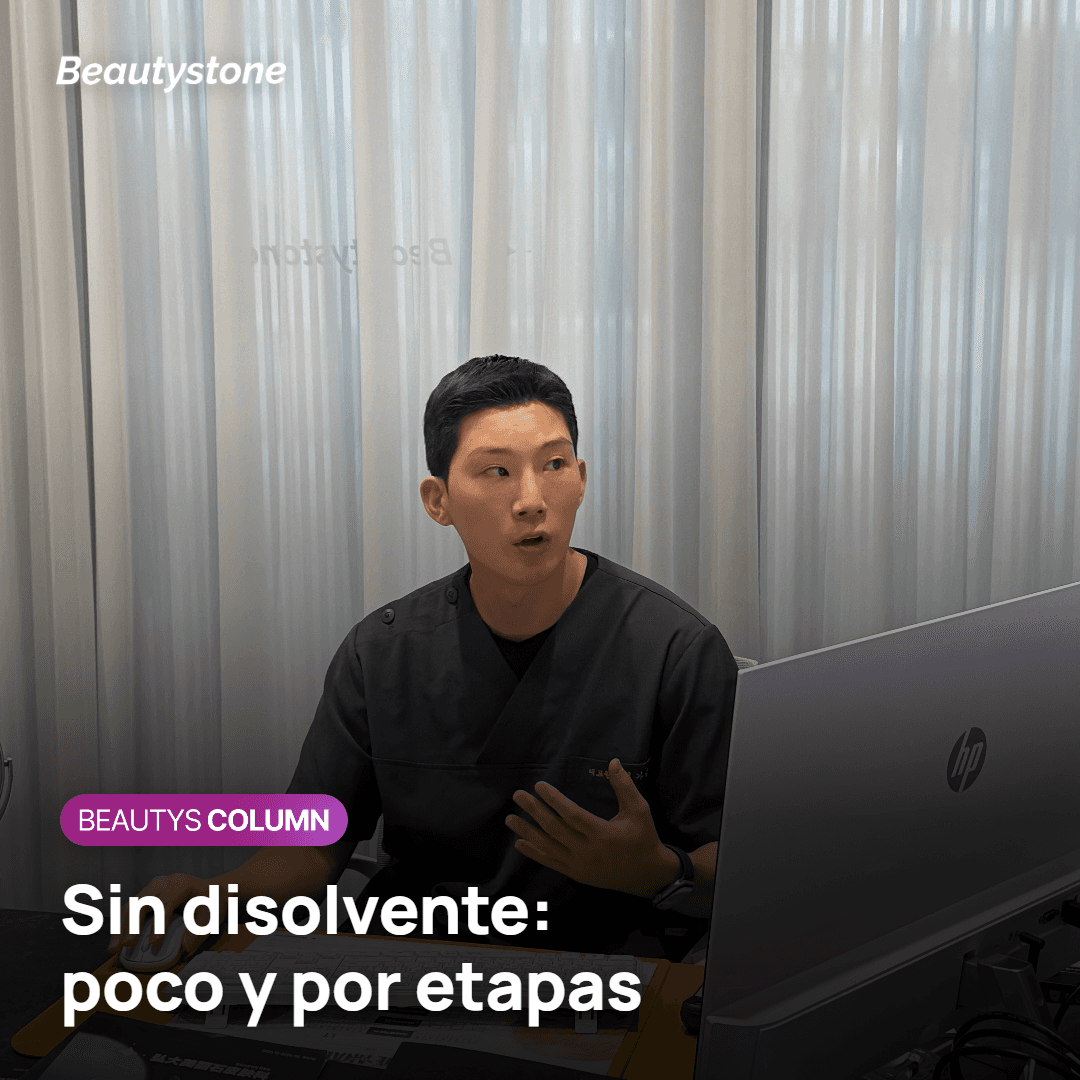 Radiesse no se disuelve: aplicación por etapas en la sien