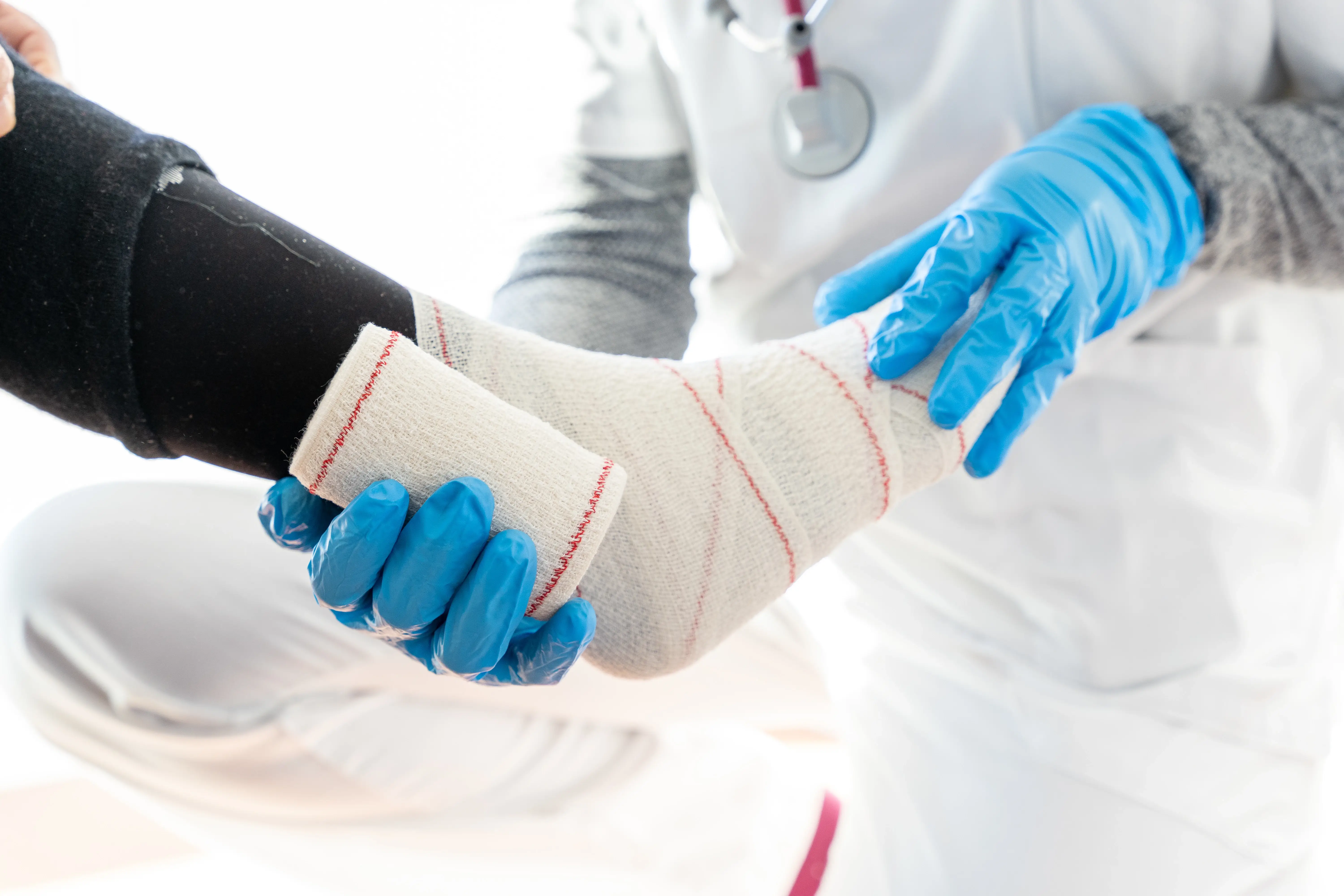 Medical professional applying a cast to support fracture healing and recovery
