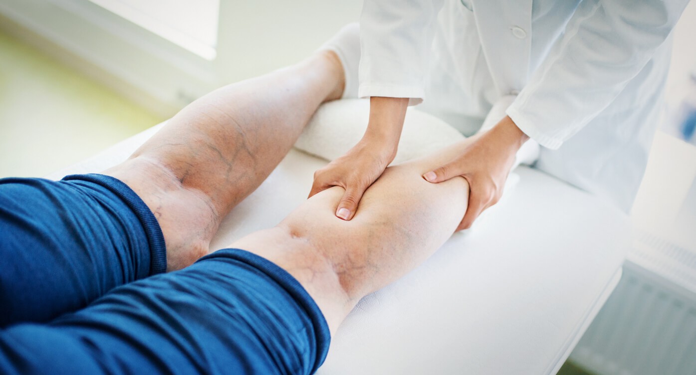 Profissional examinando pernas com varizes aparentes