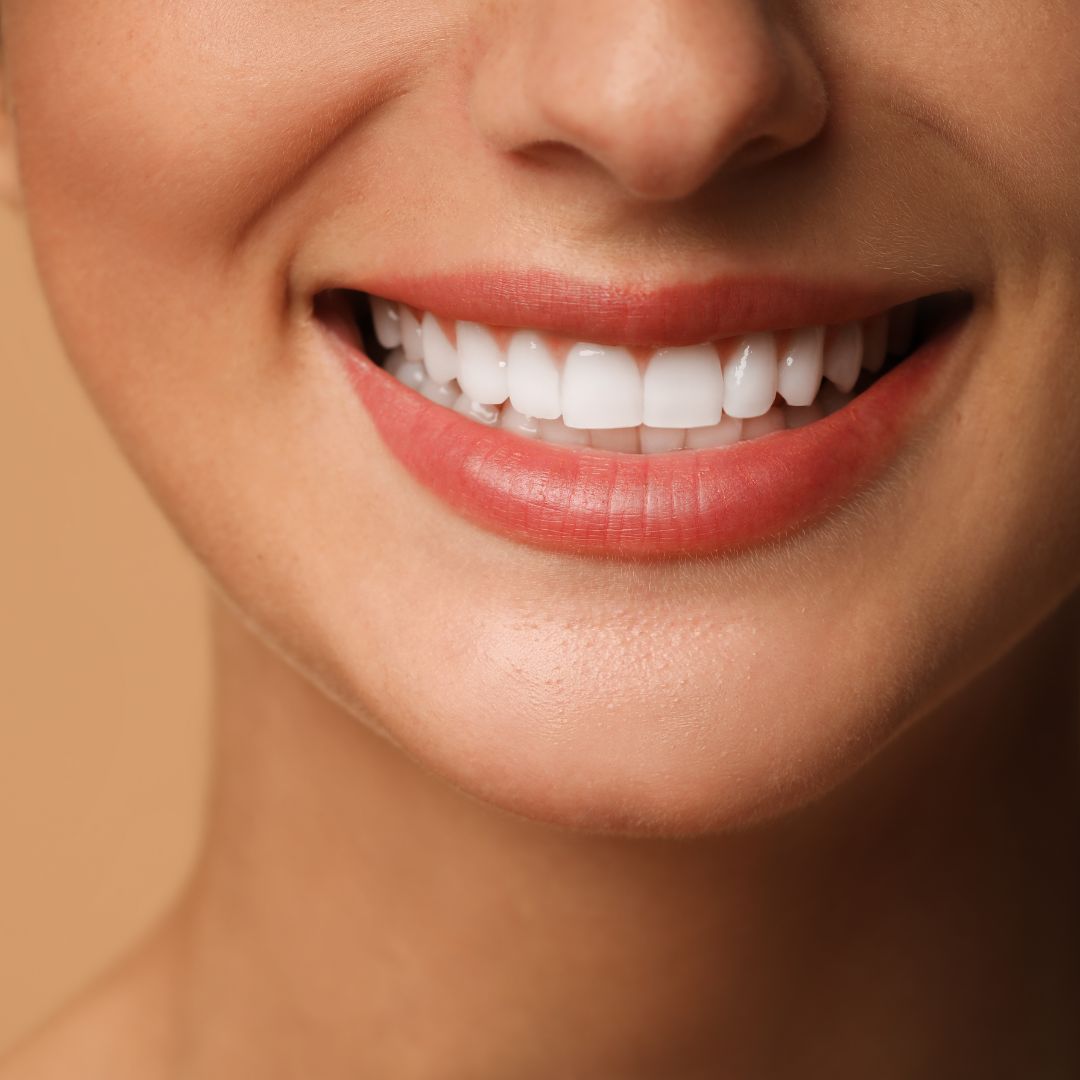 Smile makeover results at Dentistree Kolkata near Park Street