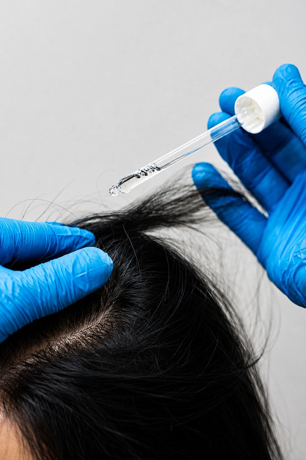 Topical treatment being applied to the scalp