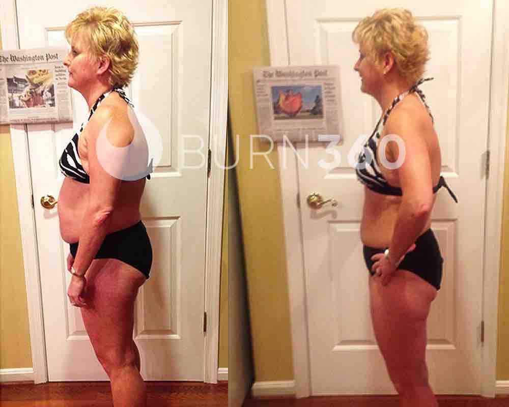 Beverly's before and after photos (side)