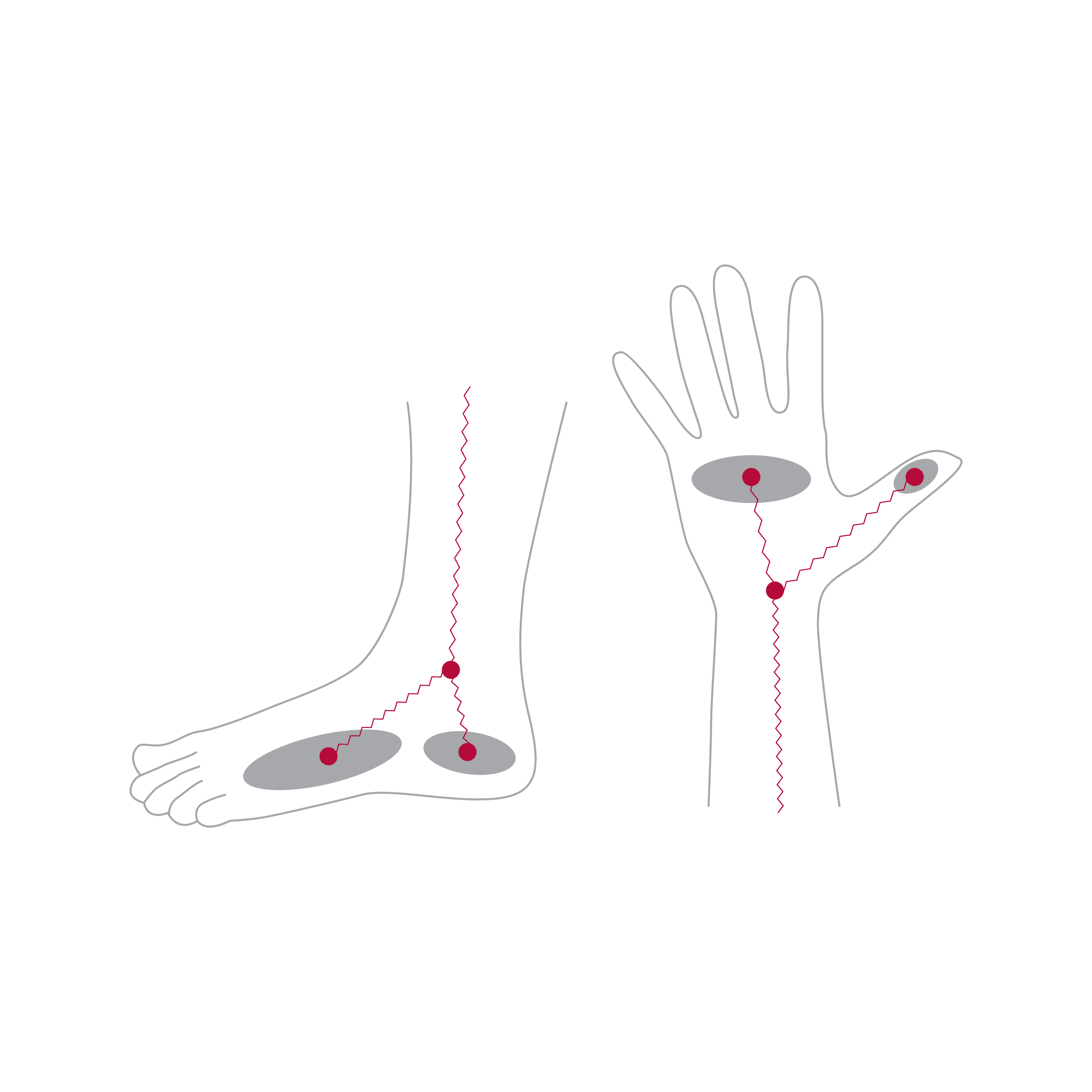 8-point Tactile Electrode System