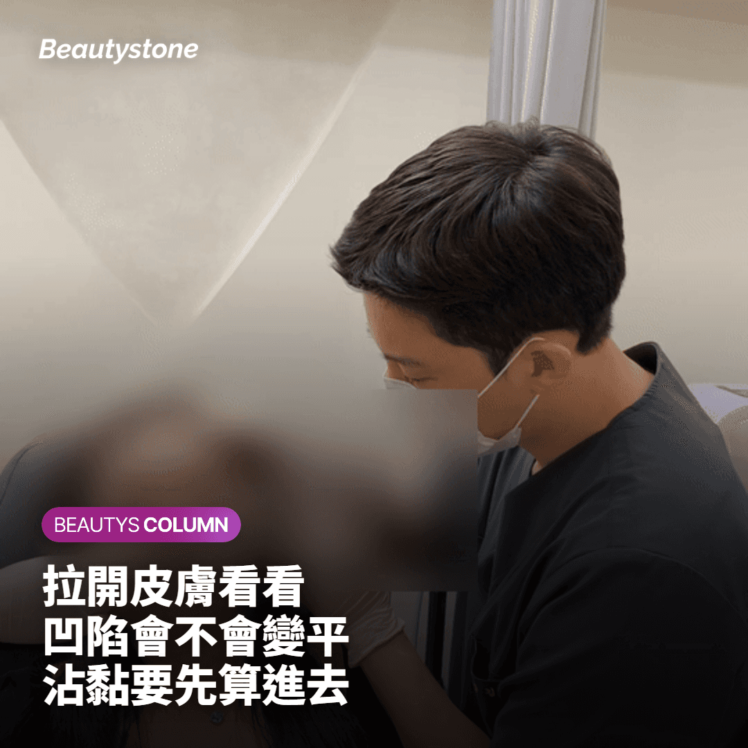 我的痘疤適合哪一種？先把皮膚往兩側拉開看看
