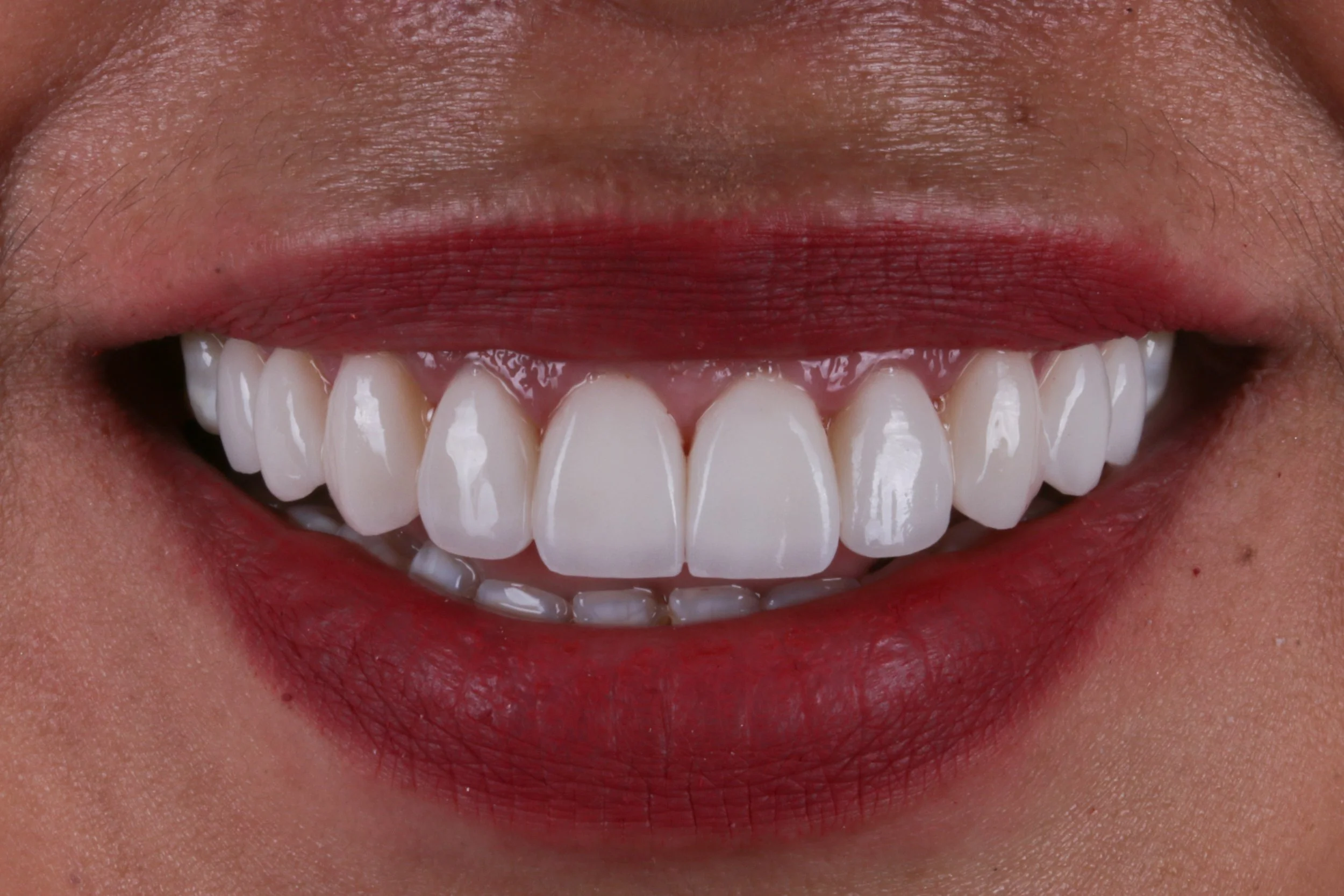 smile makeover options in leduc alberta