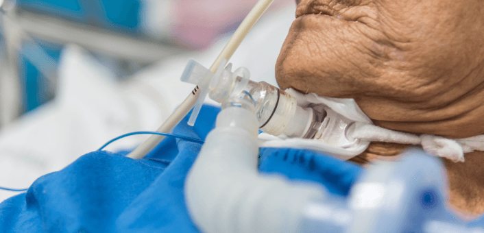 A close-up of an elderly patient's hand gripping medical tubing and connectors, likely part of an IV or ventilator setup, in a hospital setting with blue medical draping visible.