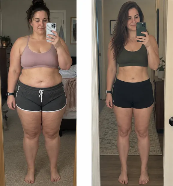 Sommar Club member before and after compounded GLP-1 treatment