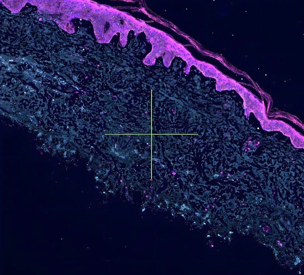 Fluorescence microscopy of human skin with a targeting crosshair.