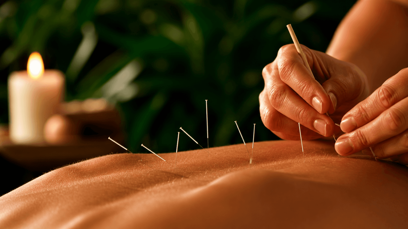 Client receiving expert dry needling treatment for pain management and improved mobility at Ember & Ice Health rehabilitation center.