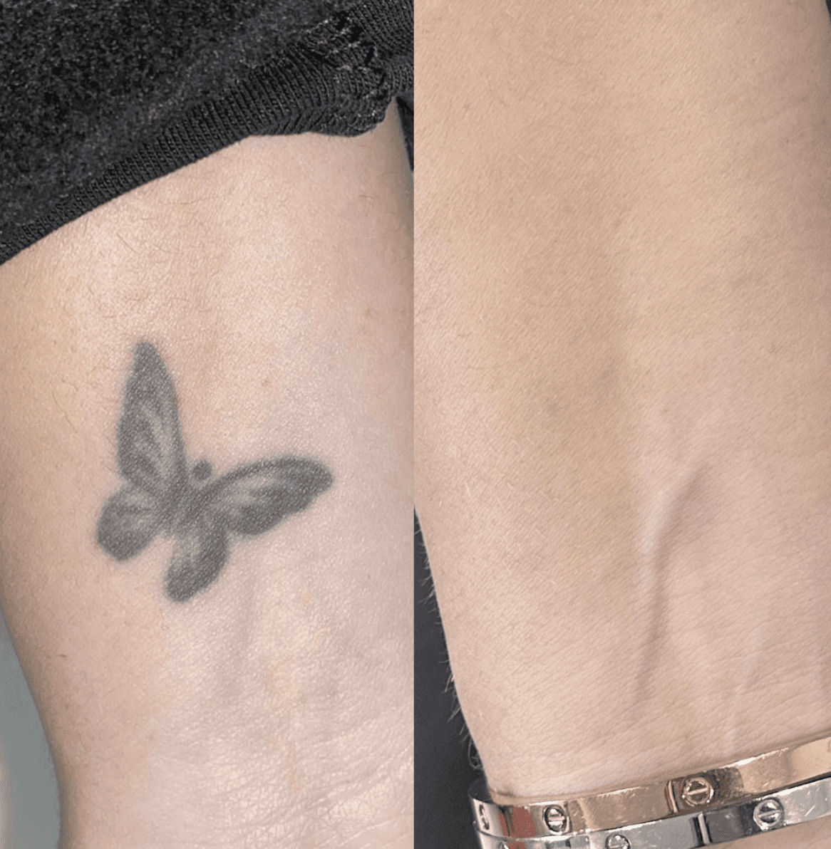 Haarpigmentierung Schweiz