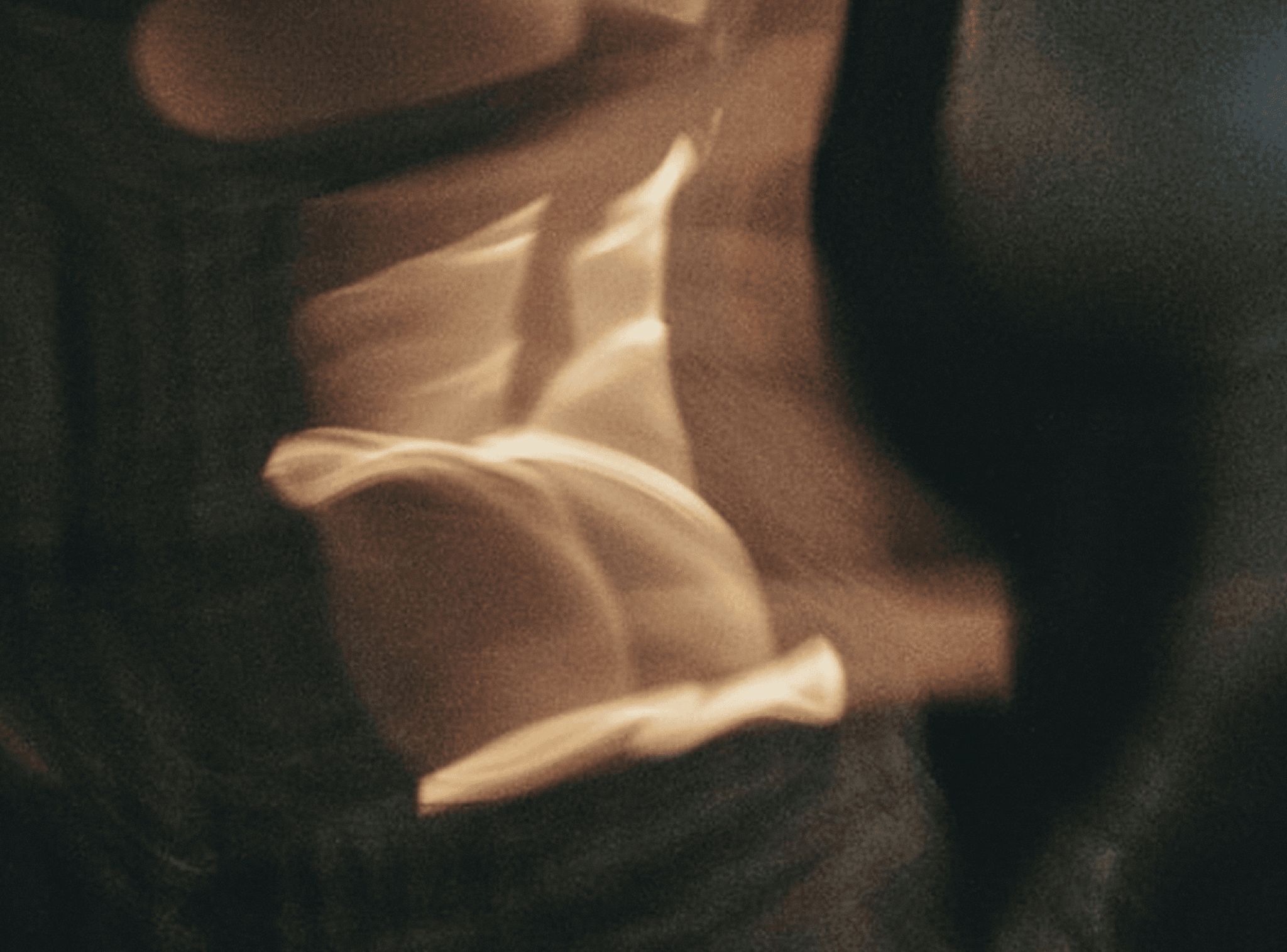 Blurred lights in warm tones