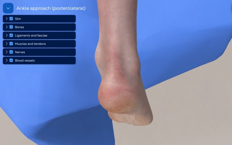 Ankle Approach - Posterolateral