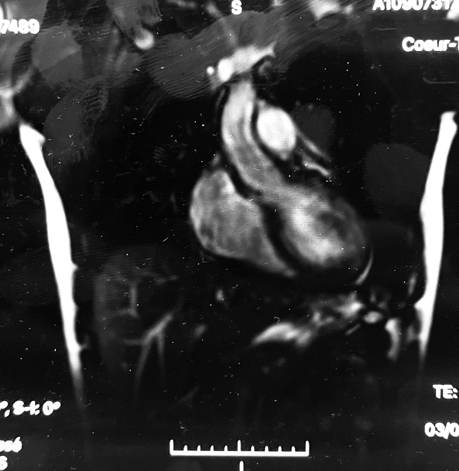 Luc Nijman - Excessive Rationality - When Too Much Reason Leads to the Irrational