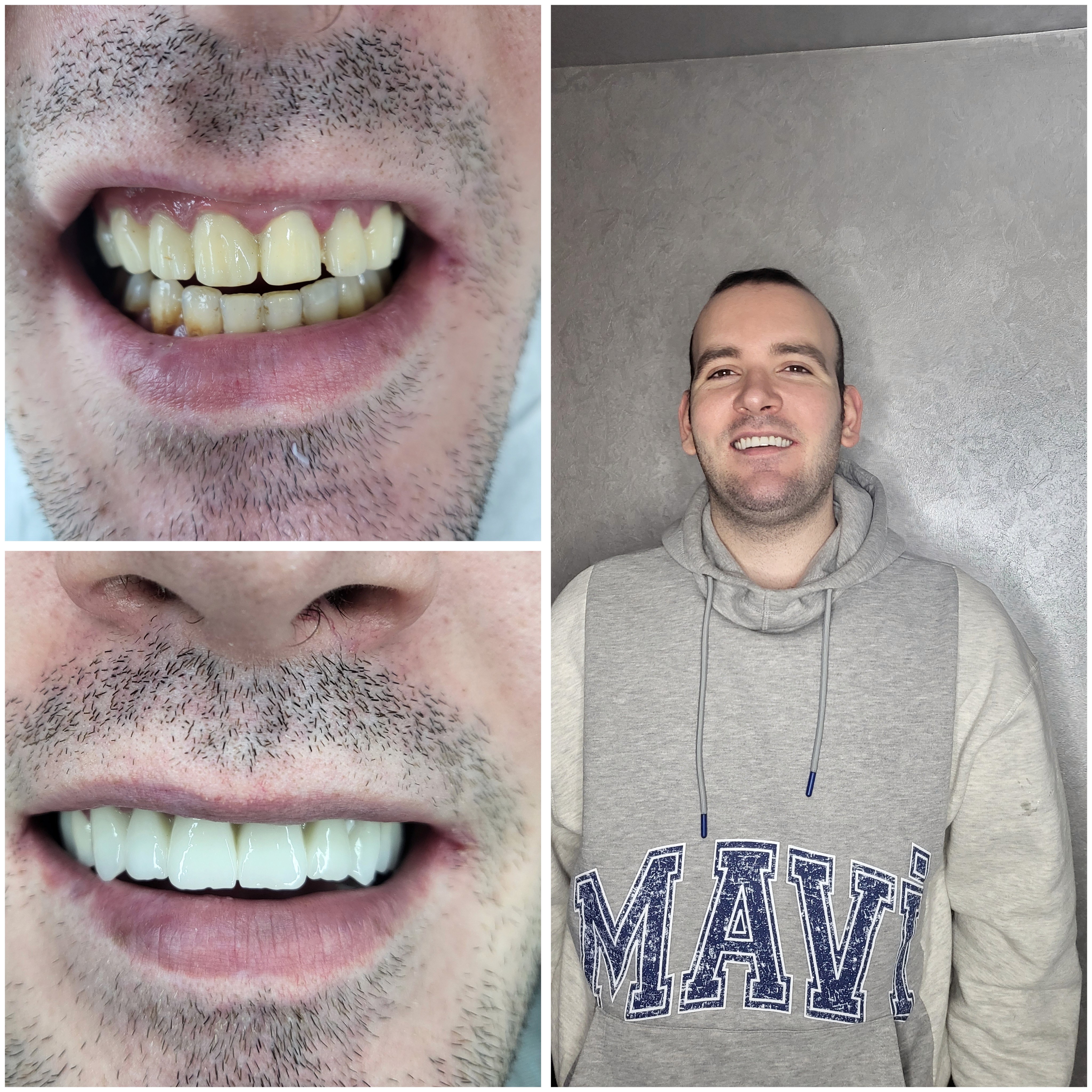 Middle aged woman smiling