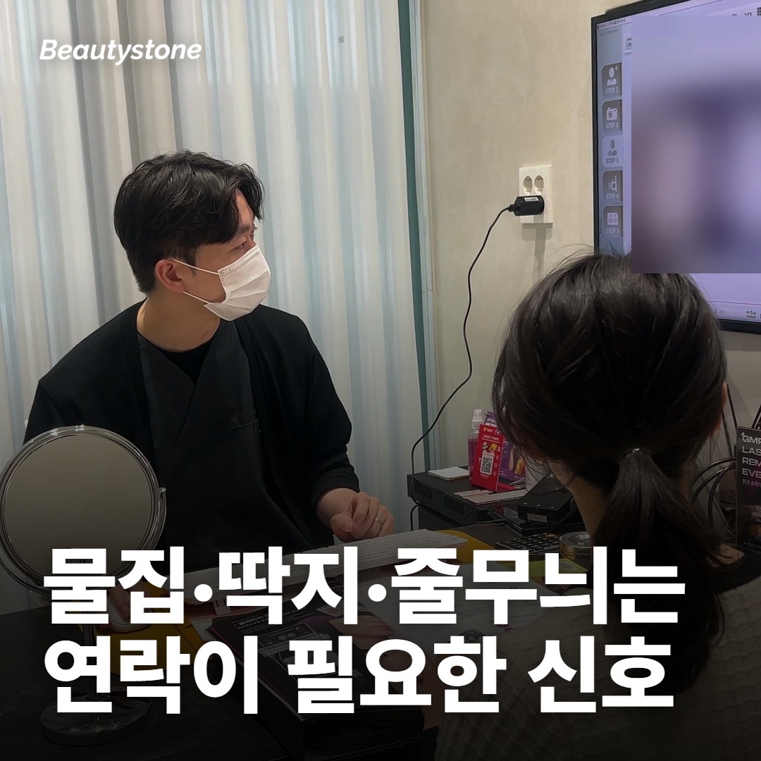 연락이 필요한 자국은 모양이 달라요