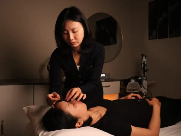 facial acupuncture for rejuvenation