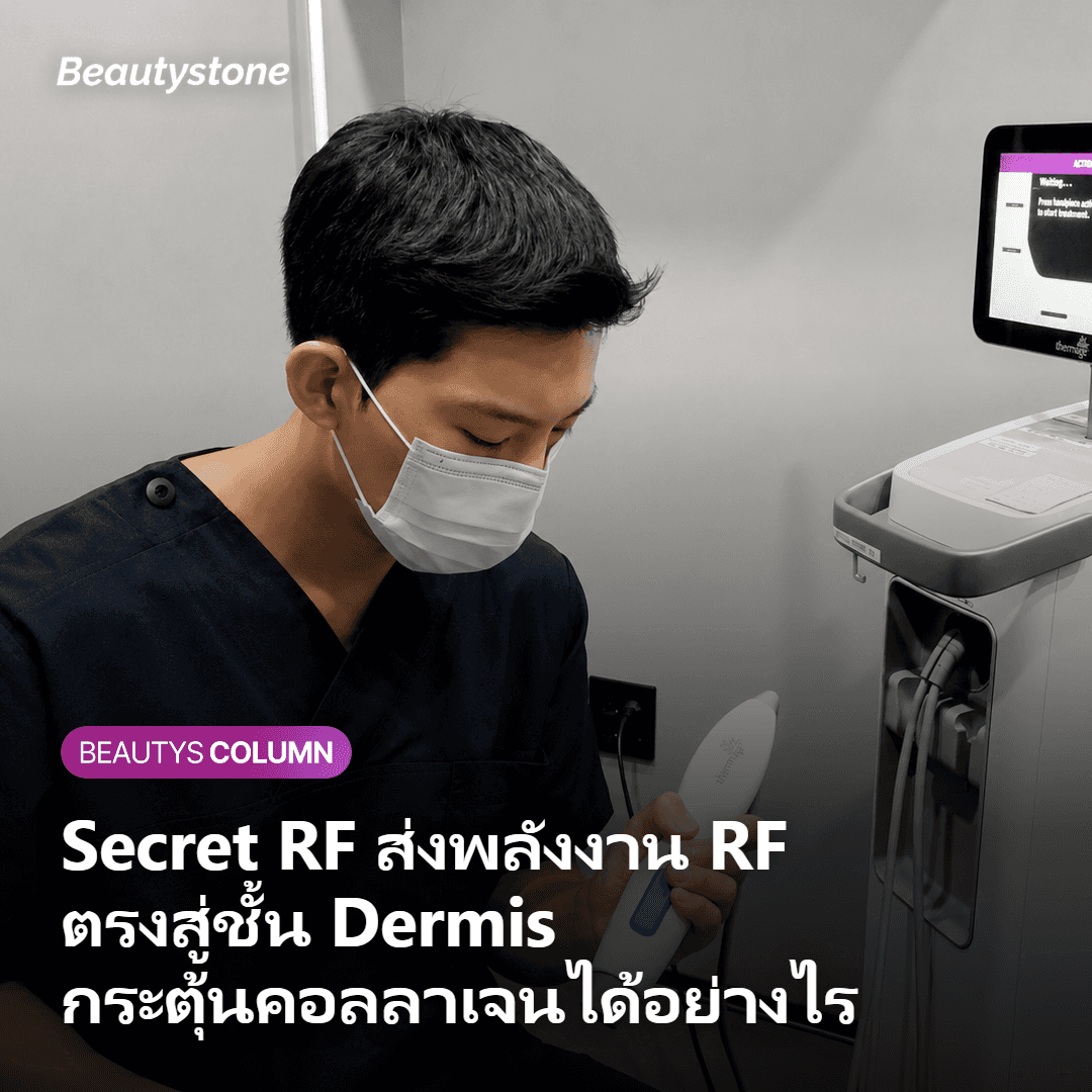 ภาพแสดงการทำงานของ Secret RF เข็มเจาะผ่านผิวหนังส่งพลังงาน RF ไปยัง Dermis กระตุ้นคอลลาเจนรอบรอยแผลเป็น